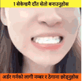 ✨🦷 Instant Teeth Whitening Liquid | Smile Care