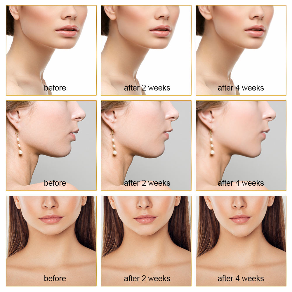 💆‍♀️🔺 Portable V-Face Slimming & Lifting Massager