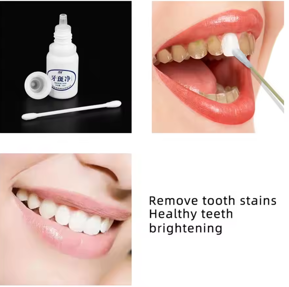 ✨🦷 Instant Teeth Whitening Liquid | Smile Care